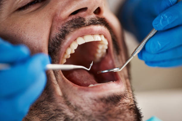 Best Cosmetic Emergency Dentistry in Fredericksburg, IA
